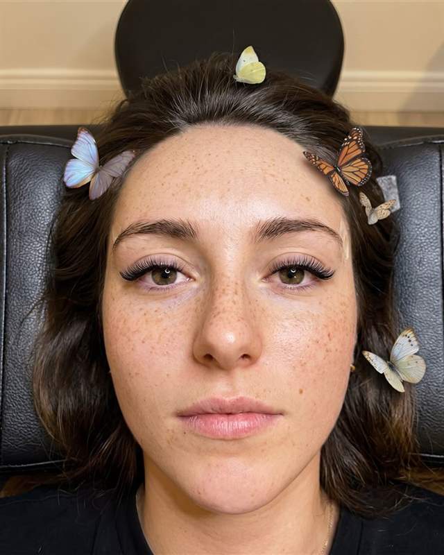 Exemplo da categoria Na maca: foto de cima